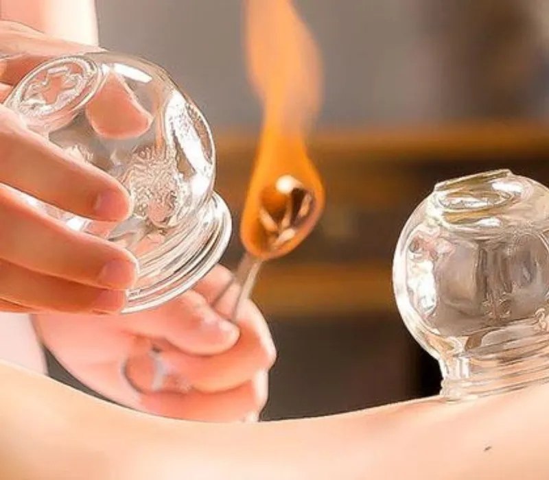 Dry Cupping & Hijama in Huddersfield — traditional cupping therapy to ease muscular tension and promote relaxation.